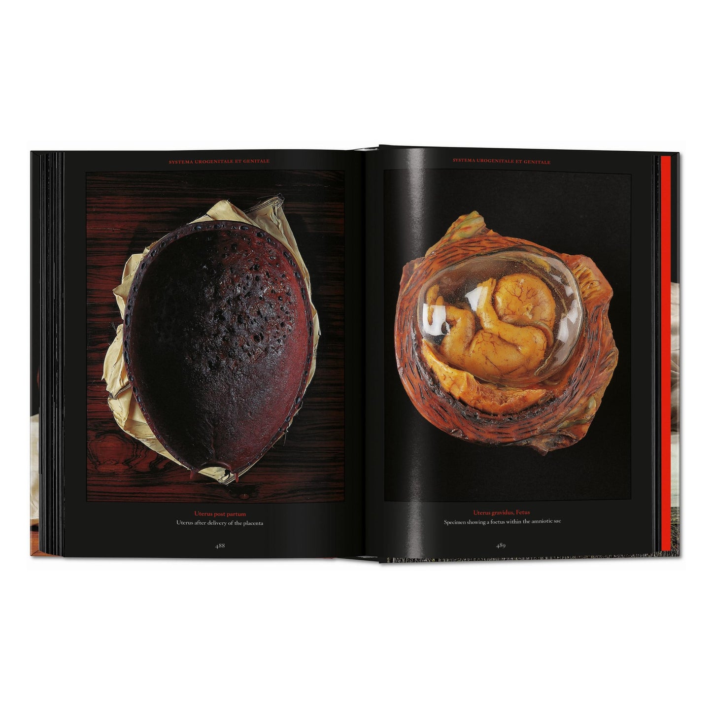 Anatomical Waxes. 45th Ed. (German, French, English) Book