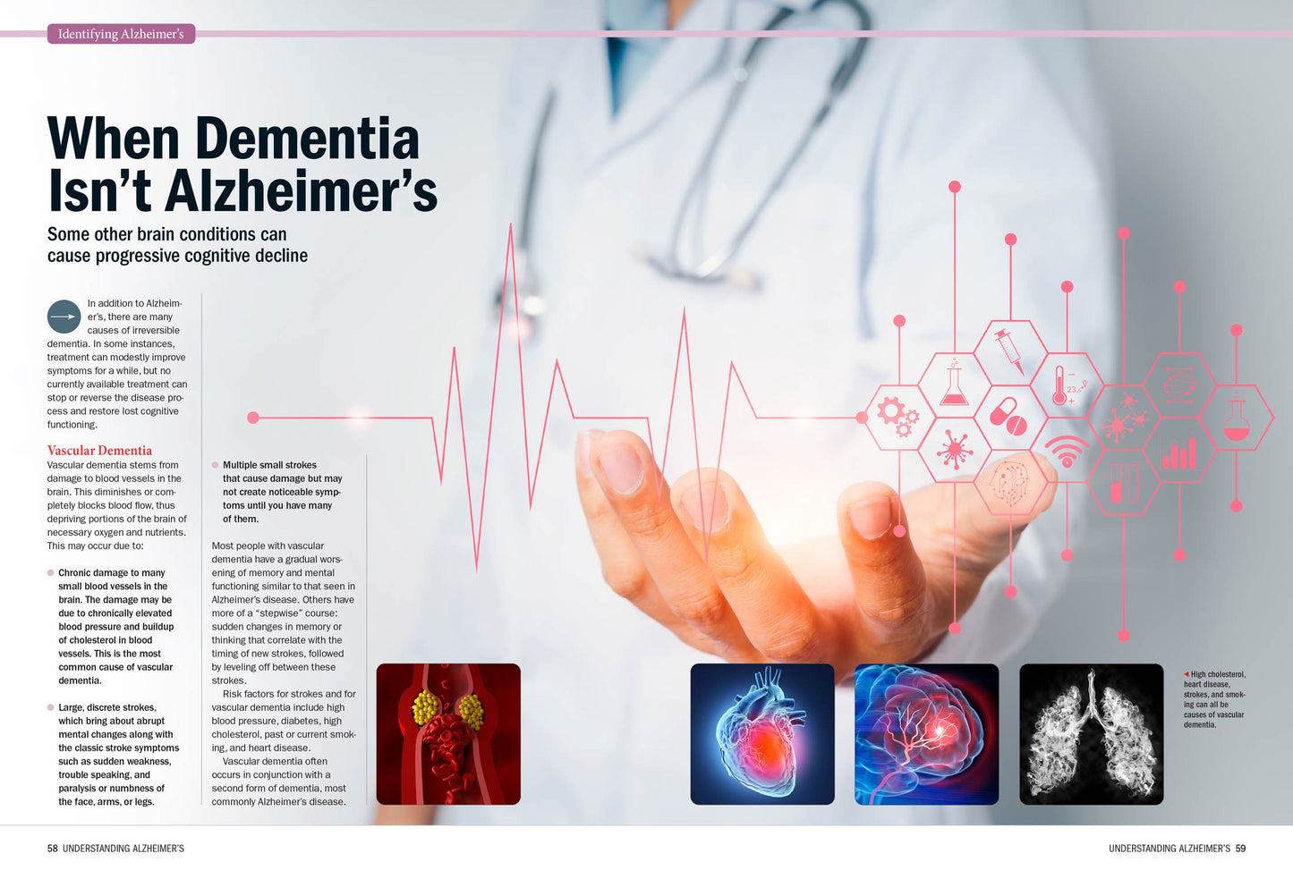 Harvard Health - Alzheimer's Disease: A Complete Guide To Reduce Risks, Treatment Options, Symptoms, Therapies, Support Strategies, Preventative Care, Medications, Understanding Alzheimer's & More!