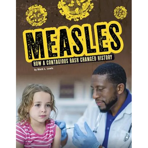 Measles: How a Contagious Rash Changed History