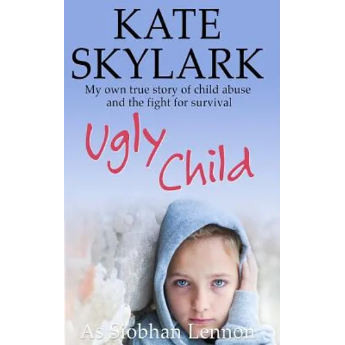 Ugly Child: My Own True Story of Child Abuse and the Fight for Survival