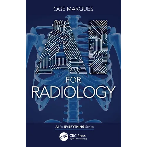 AI for Radiology