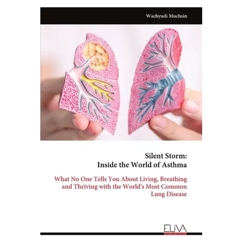 Silent Storm: Inside the World of Asthma: What No One Tells You About Living, Breathing and Thriving with the World's Most Common Lung Disease