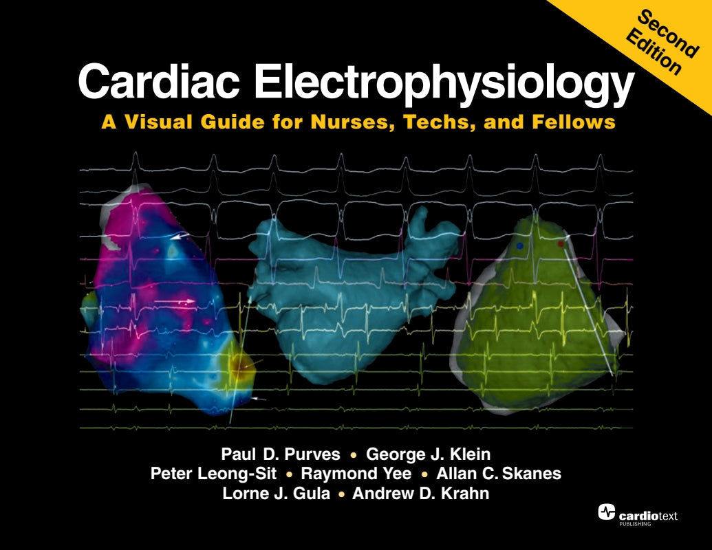 Cardiac Electrophysiology, Second Edition: A Visual Guide for Nurses, Techs, and Fellows Book