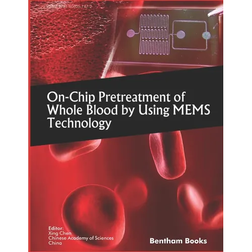 On-Chip Pretreatment of Whole Blood by Using MEMS Technology
