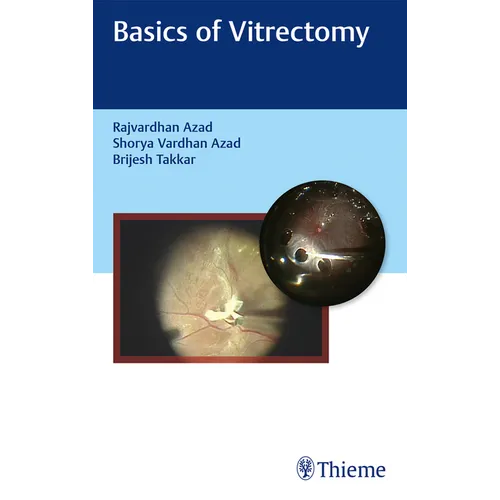 Basics of Vitrectomy