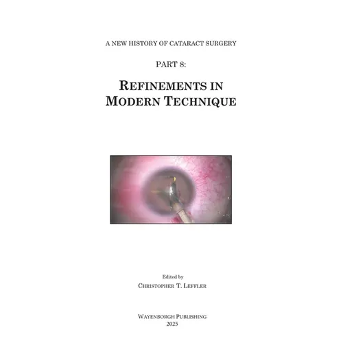 History of Cataract Surgery: Refinements in Modern Technique