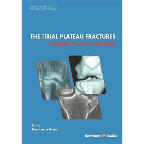 The Tibial Plateau Fractures: Diagnosis and Treatmment