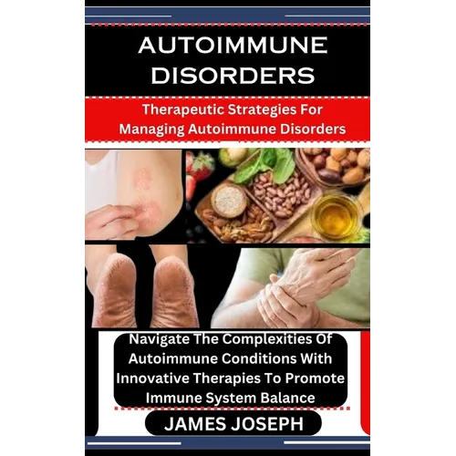 Autoimmune Disorders: Therapeutic Strategies For Managing Autoimmune Disorders: Navigate The Complexities Of Autoimmune Conditions With Inno