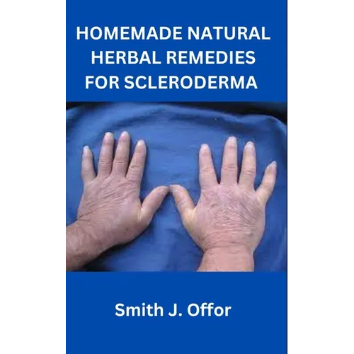 Homemade Natural Herbal Remedies for Scleroderma