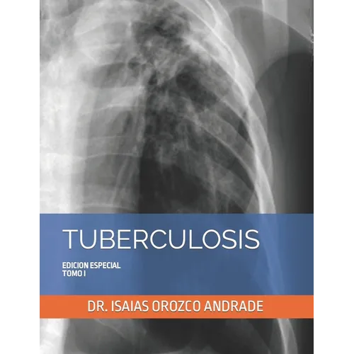 Tuberculosis: Edicion Especial. Tomo I