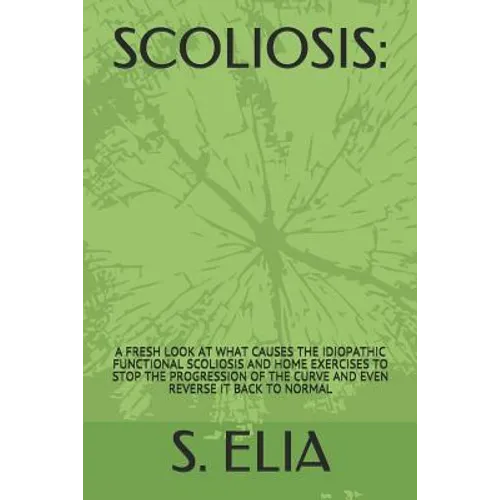 Scoliosis: : A Fresh Look at What Causes the Idiopathic Functional Scoliosis and Home Exercises to Stop the Progression of the Cu