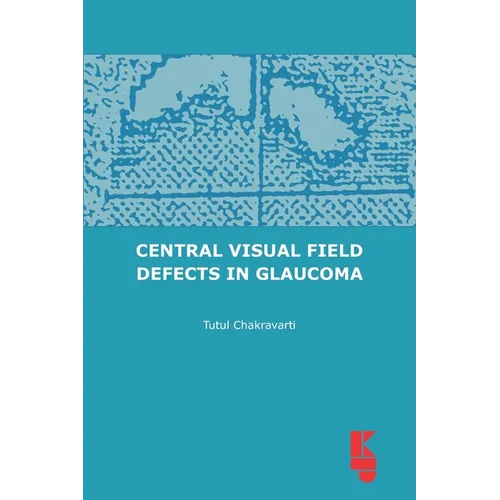 Central Visual Field Defects in Glaucoma
