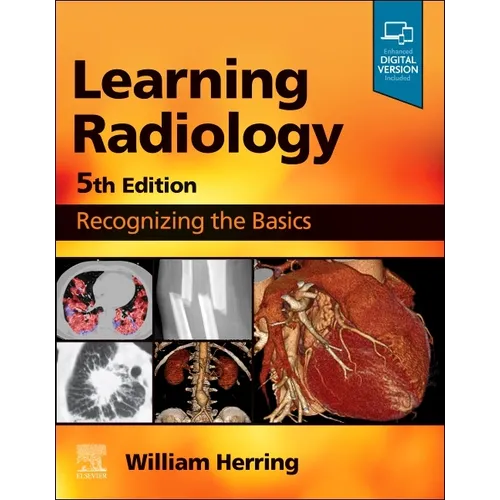 Learning Radiology: Recognizing the Basics