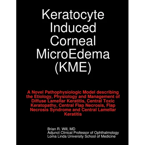 Keratocyte Induced Corneal MicroEdema