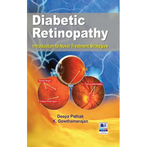 Diabetic Retinopathy: Introduction to Novel Treatment Strategies
