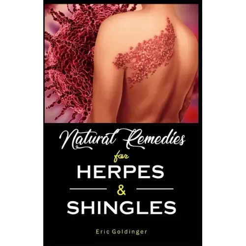 Natural Remedies For HERPES & SHINGLES: The Complete Guide