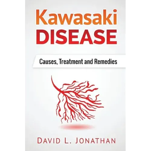 Kawasaki disease - A Slowly Developed Health Issue: Causes, Treatment and Remedies