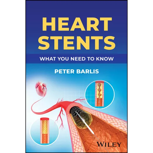 Heart Stents: What You Need to Know - Paperback