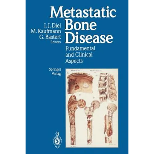 Metastatic Bone Disease: Fundamental and Clinical Aspects