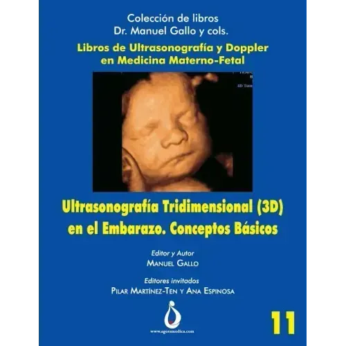 Ultrasonografia Tridimensional en el Embarazo (3D). Conceptos Básicos