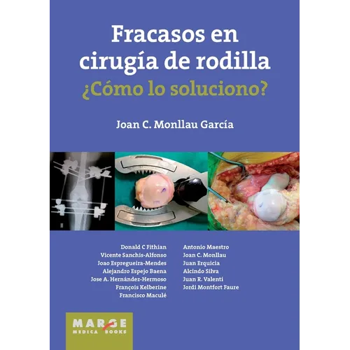 Fracasos en cirugía de rodilla ¿Cómo lo soluciono?