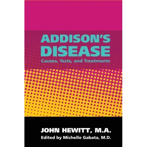 Addison's Disease: Causes, Tests, and Treatments
