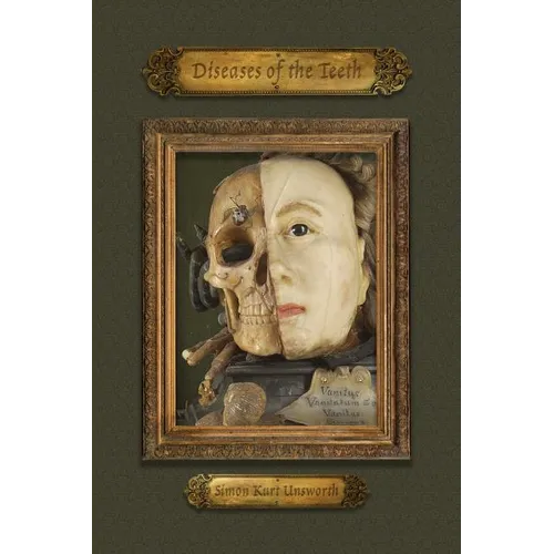 Diseases of the Teeth