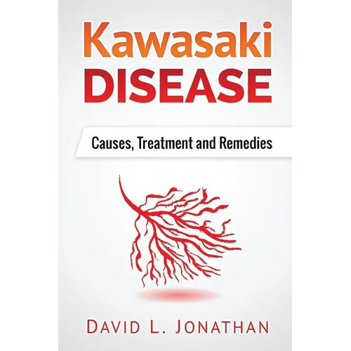Kawasaki disease - A Slowly Developed Health Issue: Causes, Treatment and Remedies