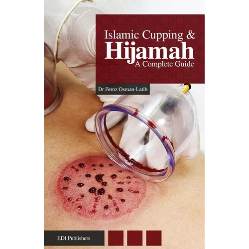 Islamic Cupping & Hijamah: A Complete Guide
