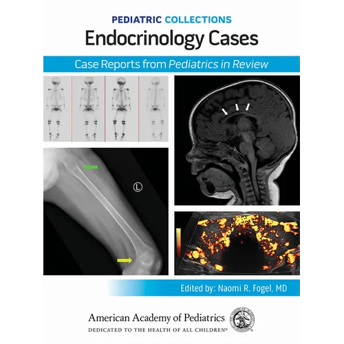 Pediatric Collections: Endocrinology Cases: Case Reports from Pediatrics in Review