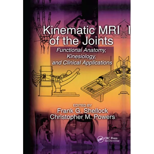 Kinematic MRI of the Joints