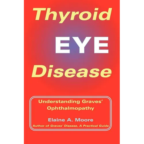 Thyroid Eye Disease: Understanding Graves' Ophthalmopathy