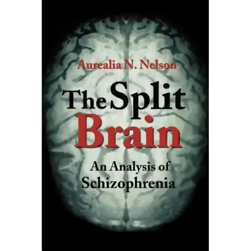 The Split Brain: An Analysis of Schizophrenia