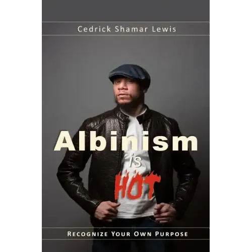 Albinism is Hot!