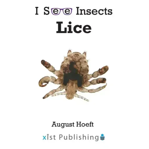 Lice