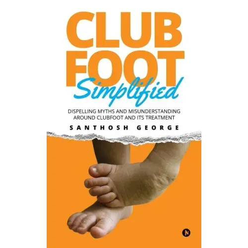 Clubfoot Simplified: Dispelling Myths and Misunderstanding around Clubfoot and its treatment