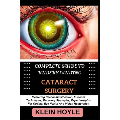 Complete Guide to Understanding Cataract Surgery: Mastering Phacoemulsification, In-Depth Techniques, Recovery Strategies, Expert Insights For Optimal