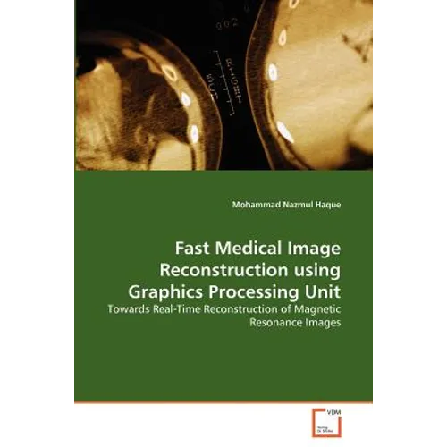Fast Medical Image Reconstruction using Graphics Processing Unit