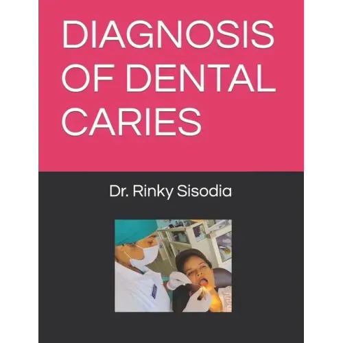 Diagnosis of Dental Caries