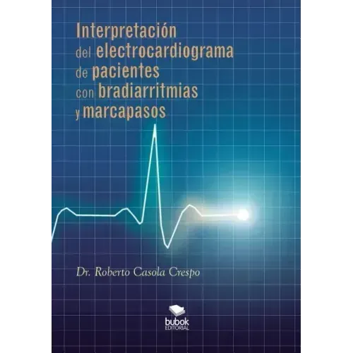 Interpretación del electrocardiograma de pacientes con bradiarritmias y marcapasos
