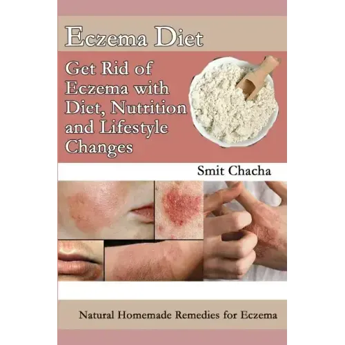 Eczema Diet - Get Rid of Eczema with Diet, Nutrition and Lifestyle Changes: Natural Homemade Remedies for Eczema