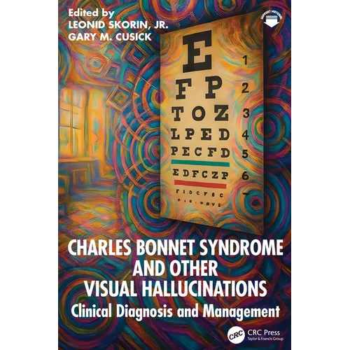 Charles Bonnet Syndrome and Other Visual Hallucinations: Clinical Diagnosis and Management