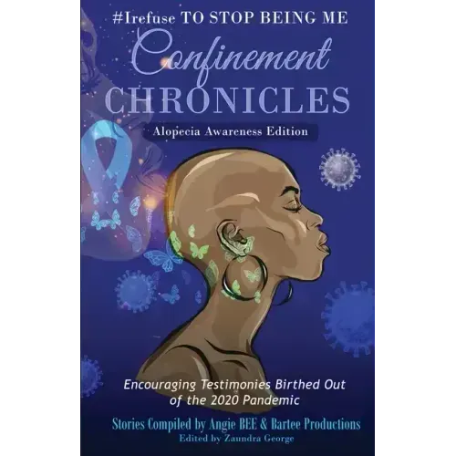 #Irefuse to Stop Being Me: Confinement Chronicles - Alopecia Awareness Edition