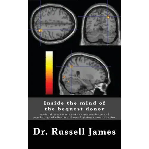 Inside the mind of the bequest donor: A visual presentation of the neuroscience and psychology of effective planned giving communication