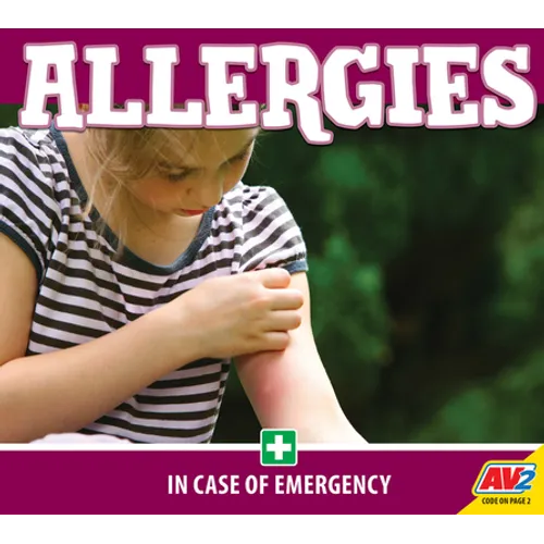 Allergies