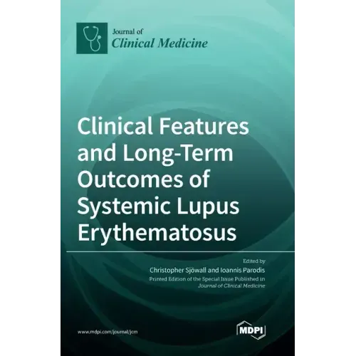Clinical Features and Long-Term Outcomes of Systemic Lupus Erythematosus