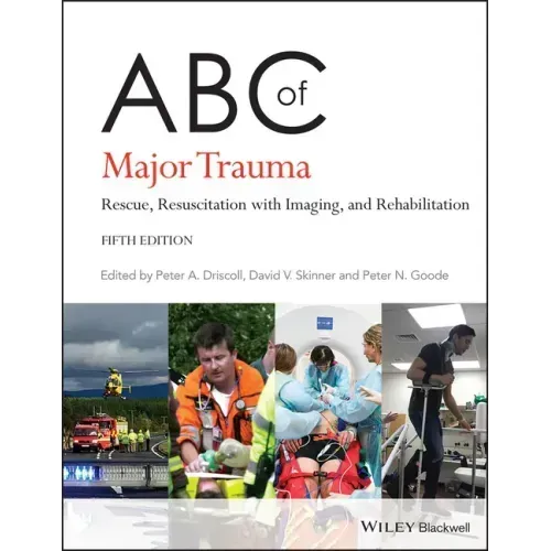 ABC of Major Trauma: Rescue, Resuscitation with Imaging, and Rehabilitation
