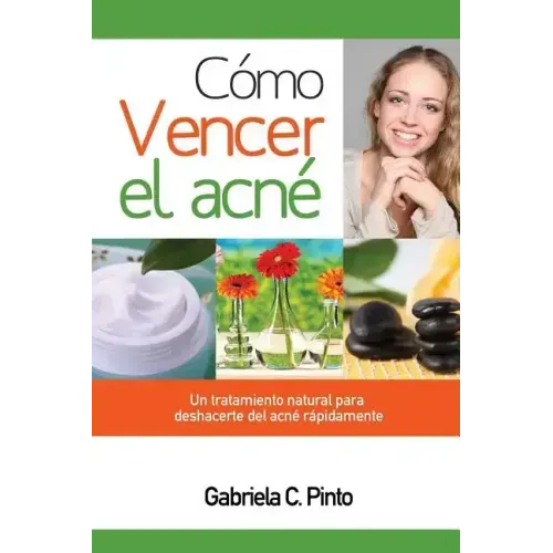 Cómo Vencer el Acné: Un tratamiento natural para deshacerte del acné rápidamente