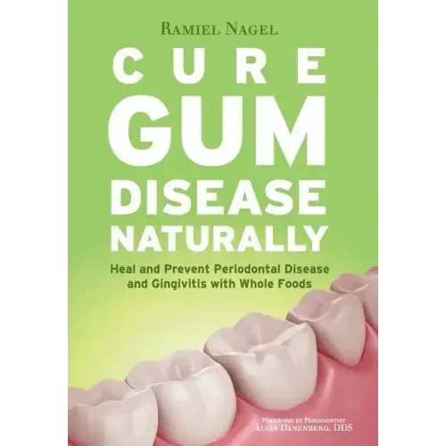 Cure Gum Disease Naturally: Heal Gingivitis and Periodontal Disease with Whole Foods