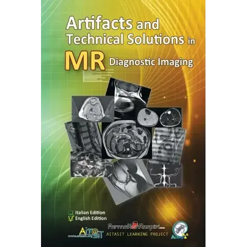 Artifacts and Technical Solutions in MR Diagnostic Imaging